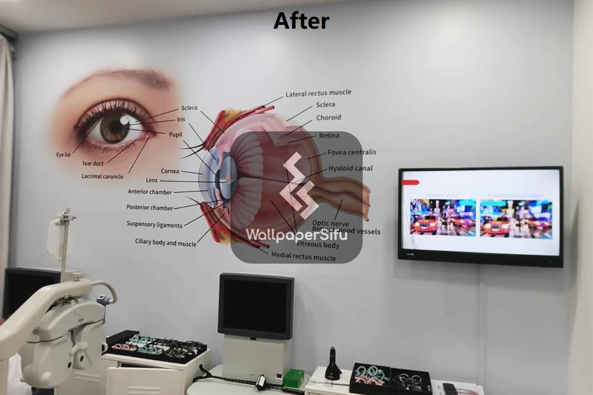 Eye Anatomy Bangi